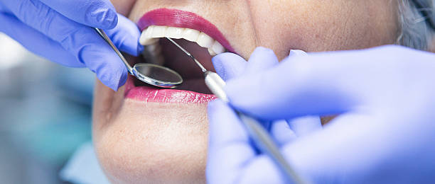 Best Dental Abscess Treatment in Beaver, UT